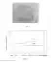 Fig. 02 - RECTAL TOPICAL LIPOGEL COMPRISING AN ANESTHETIC AGENT AND A NON-STEROIDAL ANTI-INFLAMMATORY AGENT FOR PAIN RELIEF