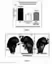 Fig. 06 - SUBSTITUTED AROMATIC COMPOUNDS AND PHARMACEUTICAL COMPOSITIONS FOR THE PREVENTION AND TREATMENT OF OSTEOPOROSIS