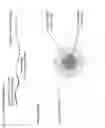 Fig. 02 - SN-38 loaded iron crosslinked micelle and methods thereof