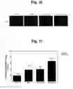 Fig. 22 - Composition for treating ischemic diseases or neuroinflammatory diseases, comprising secretome of neural precursor cells as active ingredient