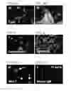 Fig. 07 - Compositions and methods for cardiac tissue repair