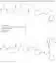 Fig. 37 - Saccharide derivative of a toxic payload and antibody conjugates thereof