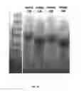 Fig. 04 - Genetically encoded intrinsically disordered stealth polymers for delivery and methods of using same