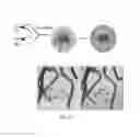 Fig. 22 - Cross-linked star-shaped self-assembled polypeptides and its use as carriers in biomedical applications