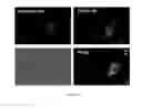 Fig. 35 - Cross-linked star-shaped self-assembled polypeptides and its use as carriers in biomedical applications