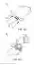Fig. 06 - Shielded Targeting Agents,  Methods, and In Vivo Diagnostic System