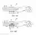 Fig. 18 - Shielded Targeting Agents,  Methods, and In Vivo Diagnostic System