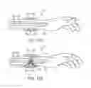 Fig. 19 - Shielded Targeting Agents,  Methods, and In Vivo Diagnostic System