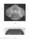 Fig. 06 - Breast milk expression apparatus and system