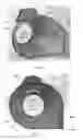 Fig. 09 - Breast milk expression apparatus and system