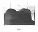 Fig. 10 - Breast milk expression apparatus and system