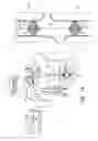 Fig. 02 - Vena-caval occlusion element
