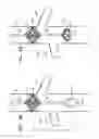 Fig. 09 - Vena-caval occlusion element