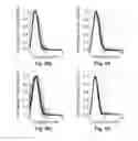 Fig. 12 - Method and apparatus for determining aortic valve opening