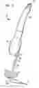 Fig. 03 - Wire scaffold device for ventricular assist device