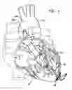 Fig. 05 - Wire scaffold device for ventricular assist device