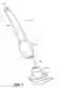 Fig. 06 - Wire scaffold device for ventricular assist device
