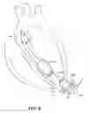 Fig. 09 - Wire scaffold device for ventricular assist device