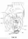 Fig. 12 - Wire scaffold device for ventricular assist device