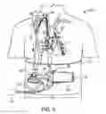 Fig. 06 - VA ECMO with pulmonary artery ventilation