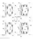 Fig. 15 - Assembly to administer insulin from a cartridge