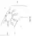 Fig. 136 - Adhesive and peripheral systems and methods for medical devices