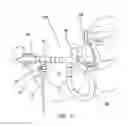 Fig. 12 - Nebulizer apparatus