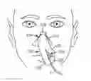 Fig. 01 - Nasogastric tube securement systems and methods of using same
