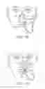 Fig. 06 - Nasogastric tube securement systems and methods of using same