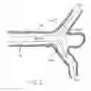 Fig. 03 - Temporary bypass balloon catheter