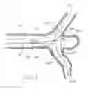 Fig. 04 - Temporary bypass balloon catheter