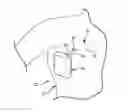 Fig. 01 - Surgical drain system and container