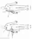 Fig. 09 - Medical fluid drainage system
