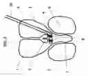 Fig. 09 - Methods and systems for intraventricular brain stimulation