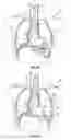 Fig. 04 - Hemodynamic performance enhancement through asymptomatic diaphragm stimulation
