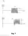 Fig. 08 - Systems and methods for determining a stapedius reflex threshold based on electro-acoustic stimulation