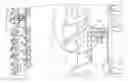 Fig. 01 - High density epidural stimulation for facilitation of locomotion, posture, voluntary movement, and recovery of autonomic, sexual, vasomotor, and cognitive function after neurological injury