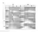 Fig. 09 - NITROGEN-BASED, LOW-TEMPERATURE ATMOSPHERIC PRESSUE PLASMA FOR TREATING MUSCLE DAMAGE