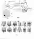 Fig. 04 - METHOD AND DEVICE FOR BODY FLUID STIMULATION