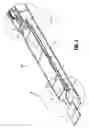 Fig. 06 - Buttress brachytherapy and integrated staple line markers for margin identification