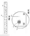 Fig. 20 - Buttress brachytherapy and integrated staple line markers for margin identification