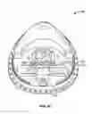 Fig. 07 - RESISTANCE BREATHING DEVICE
