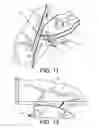 Fig. 05 - SAFETY KNIFE
