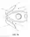 Fig. 12 - SAFETY KNIFE