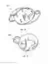 Fig. 08 - Quilling device