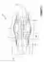 Fig. 02 - ANTI-ICING SYSTEM FOR GAS TURBINE ENGINE