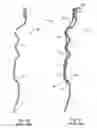 Fig. 04 - Apparatus and methods of forming and applying roll-on pilfer proof closures on the threaded neck of metal containers