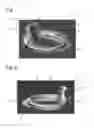 Fig. 05 - DISPOSABLE SODA CAN LID