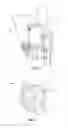 Fig. 03 - TITANIUM-DIAMOND WELD HARDFACING COMPOSITION, METHOD AND APPARATUS