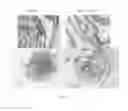 Fig. 09 - Humanized anti-DKK2 antibody and uses thereof